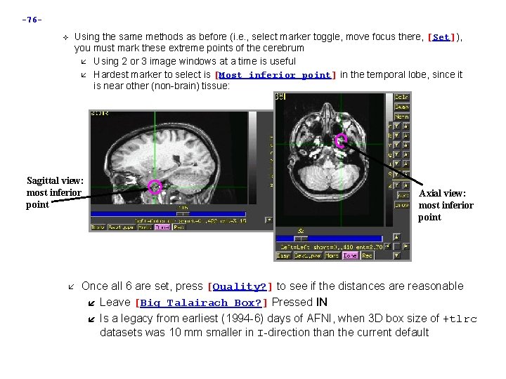 -76 Using the same methods as before (i. e. , select marker toggle, move