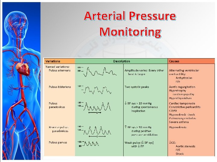 Arterial Pressure Monitoring 