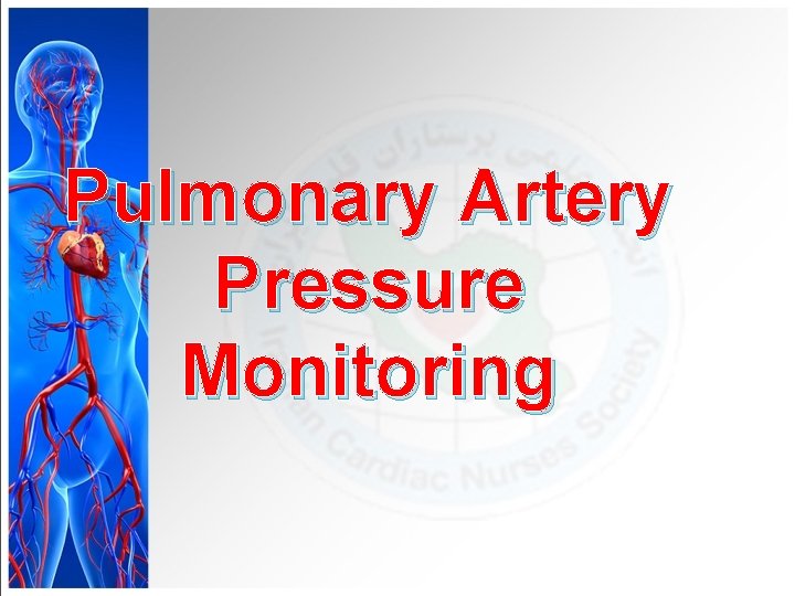 Pulmonary Artery Pressure Monitoring 