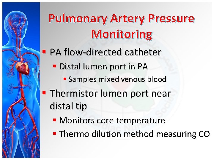 Pulmonary Artery Pressure Monitoring § PA flow-directed catheter § Distal lumen port in PA