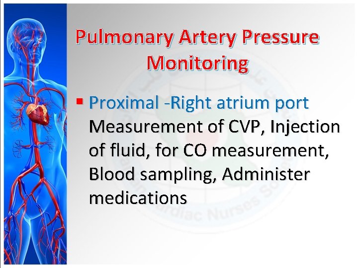 Pulmonary Artery Pressure Monitoring § Proximal -Right atrium port Measurement of CVP, Injection of