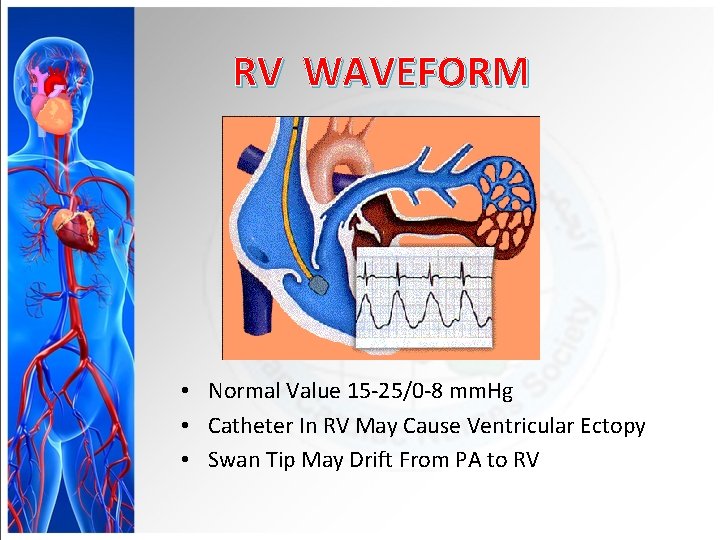 RV WAVEFORM • Normal Value 15 -25/0 -8 mm. Hg • Catheter In RV