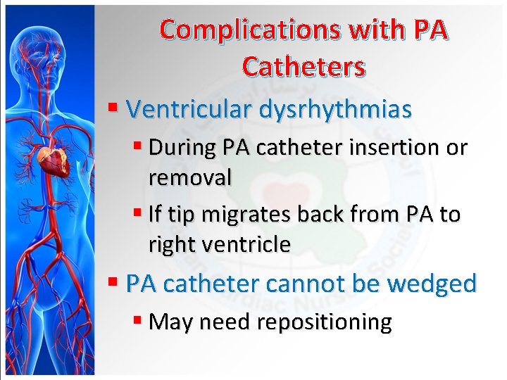 Complications with PA Catheters § Ventricular dysrhythmias § During PA catheter insertion or removal