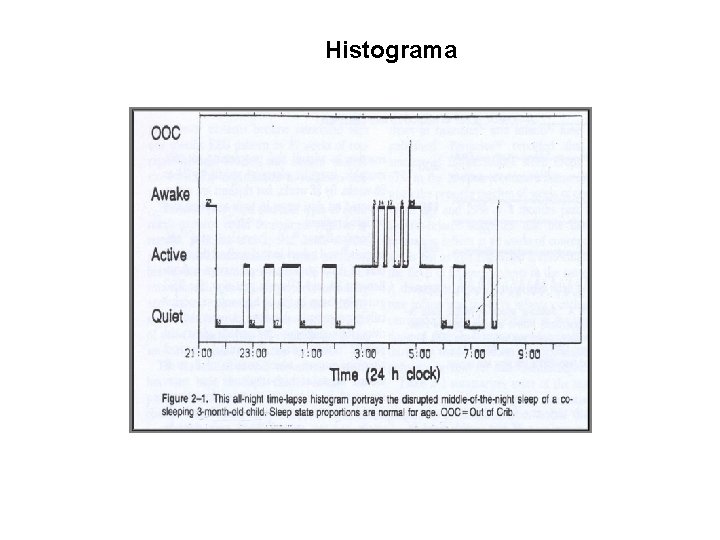 Histograma 