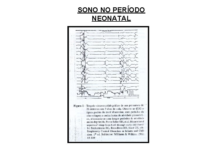 SONO NO PERÍODO NEONATAL 