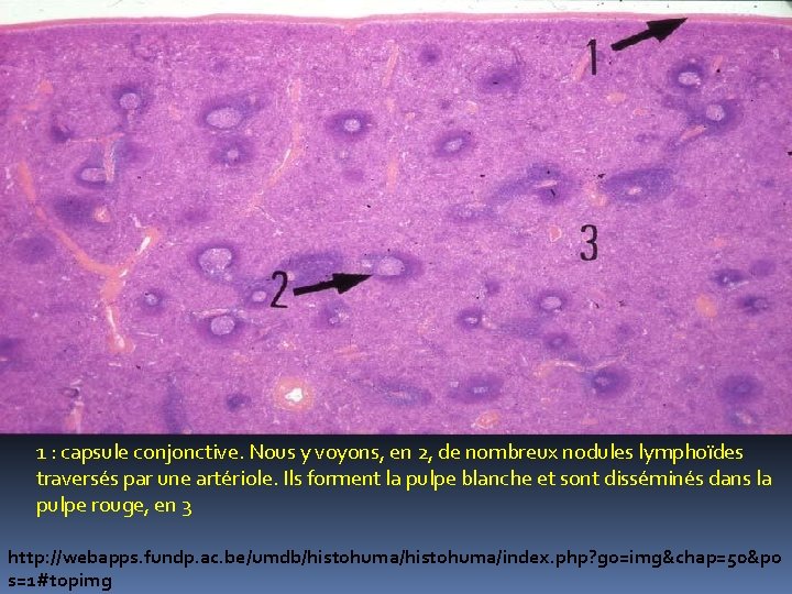 1 : capsule conjonctive. Nous y voyons, en 2, de nombreux nodules lymphoïdes traversés