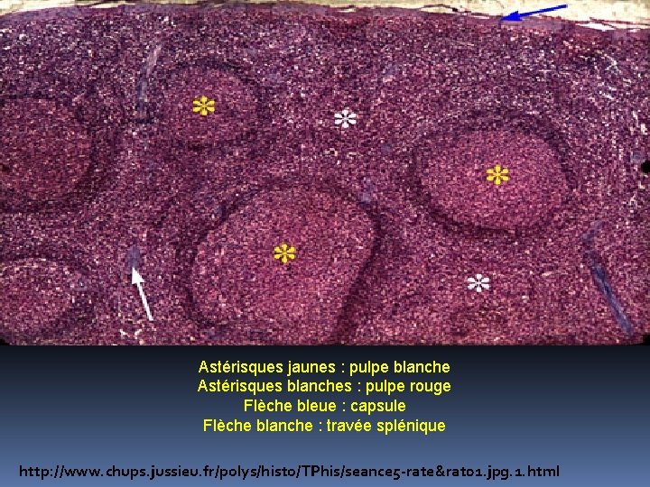 Astérisques jaunes : pulpe blanche Astérisques blanches : pulpe rouge Flèche bleue : capsule