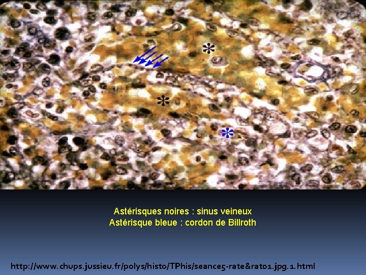 Astérisques noires : sinus veineux Astérisque bleue : cordon de Billroth http: //www. chups.