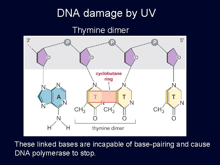 DNA damage by UV Thymine dimer These linked bases are incapable of base-pairing and