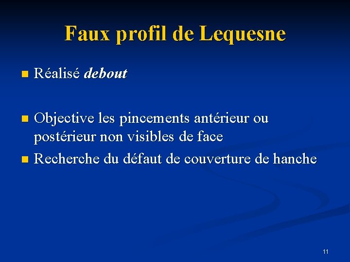 Faux profil de Lequesne n Réalisé debout Objective les pincements antérieur ou postérieur non