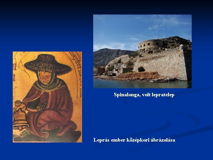 Spinalonga, volt lepratelep Leprás ember középkori ábrázolása 