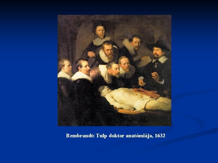 Rembrandt: Tulp doktor anatómiája, 1632 