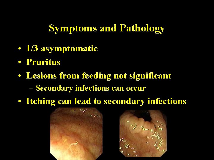 Symptoms and Pathology • 1/3 asymptomatic • Pruritus • Lesions from feeding not significant Symptoms and Pathology • 1/3 asymptomatic • Pruritus • Lesions from feeding not significant
