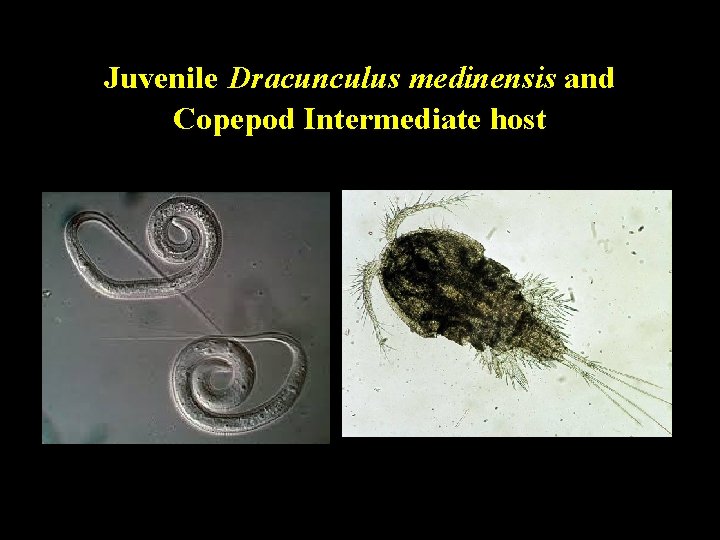 Juvenile Dracunculus medinensis and Copepod Intermediate host Juvenile Dracunculus medinensis and Copepod Intermediate host