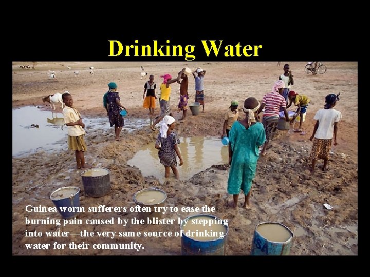 Drinking Water Guinea worm sufferers often try to ease the burning pain caused by Drinking Water Guinea worm sufferers often try to ease the burning pain caused by