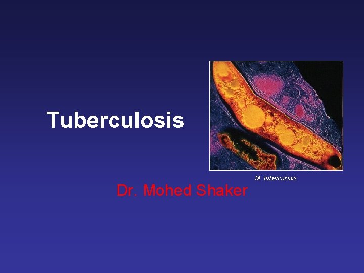 Tuberculosis Dr. Mohed Shaker M. tuberculosis 