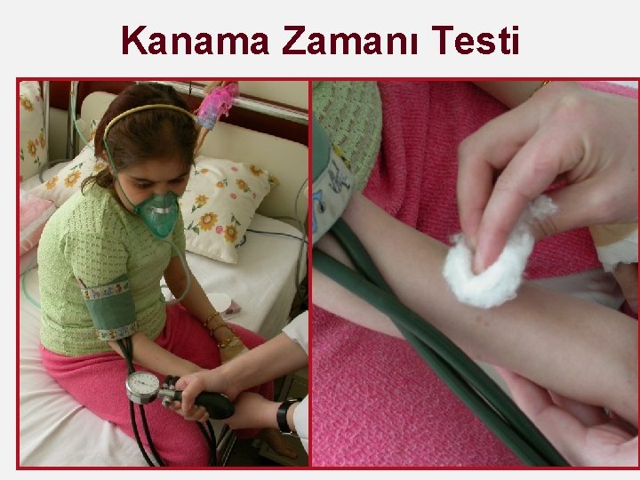 Kanama Zamanı Testi 