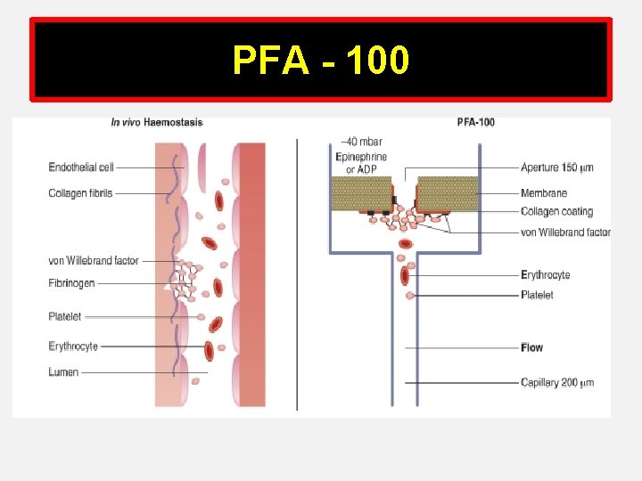 PFA - 100 