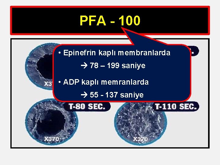 PFA - 100 • Epinefrin kaplı membranlarda 78 – 199 saniye • ADP kaplı