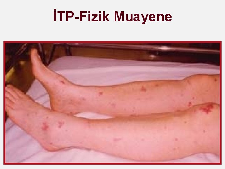 İTP-Fizik Muayene 