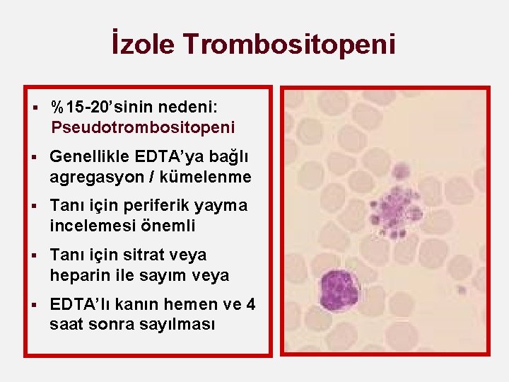 İzole Trombositopeni § %15 -20’sinin nedeni: Pseudotrombositopeni § Genellikle EDTA’ya bağlı agregasyon / kümelenme