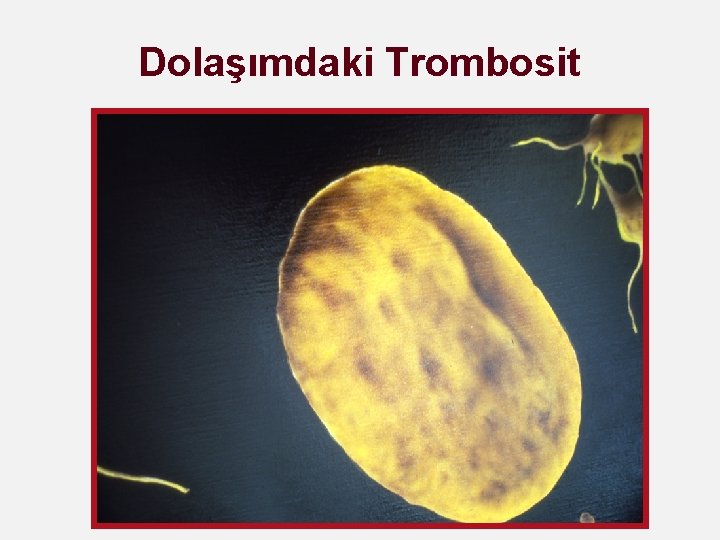 Dolaşımdaki Trombosit 