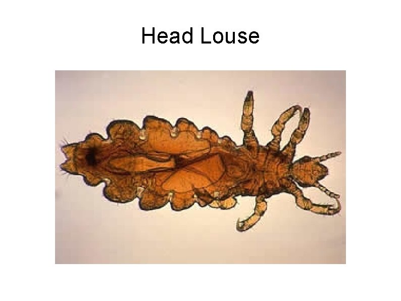 Head Louse 