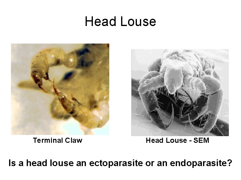 Head Louse Terminal Claw Head Louse - SEM Is a head louse an ectoparasite