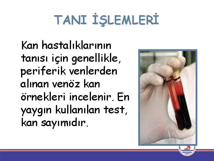 TANI İŞLEMLERİ Kan hastalıklarının tanısı için genellikle, periferik venlerden alınan venöz kan örnekleri incelenir.