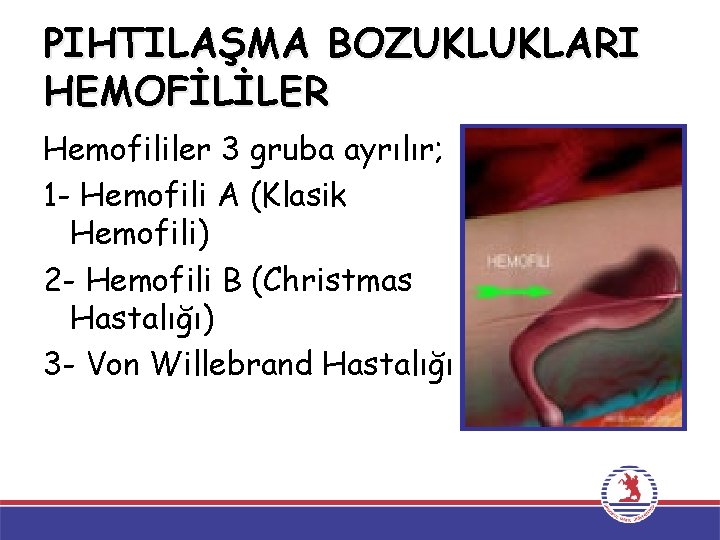 PIHTILAŞMA BOZUKLUKLARI HEMOFİLİLER Hemofililer 3 gruba ayrılır; 1 - Hemofili A (Klasik Hemofili) 2