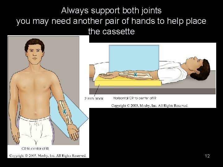 Always support both joints you may need another pair of hands to help place