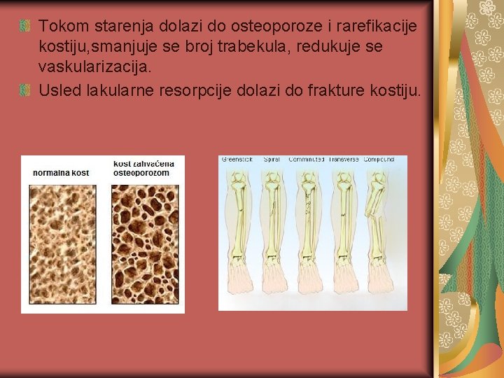 Tokom starenja dolazi do osteoporoze i rarefikacije kostiju, smanjuje se broj trabekula, redukuje se