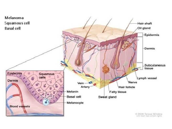 Melanoma Squamous cell Basal cell 