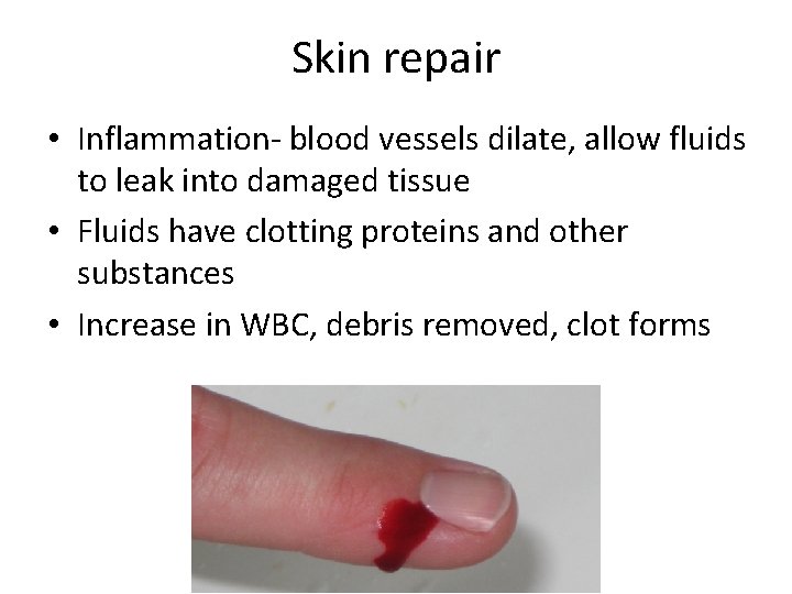 Skin repair • Inflammation- blood vessels dilate, allow fluids to leak into damaged tissue
