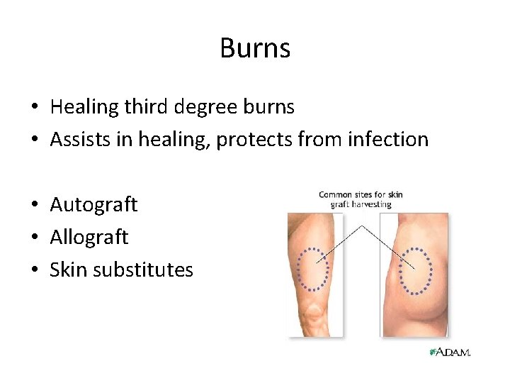 Burns • Healing third degree burns • Assists in healing, protects from infection •