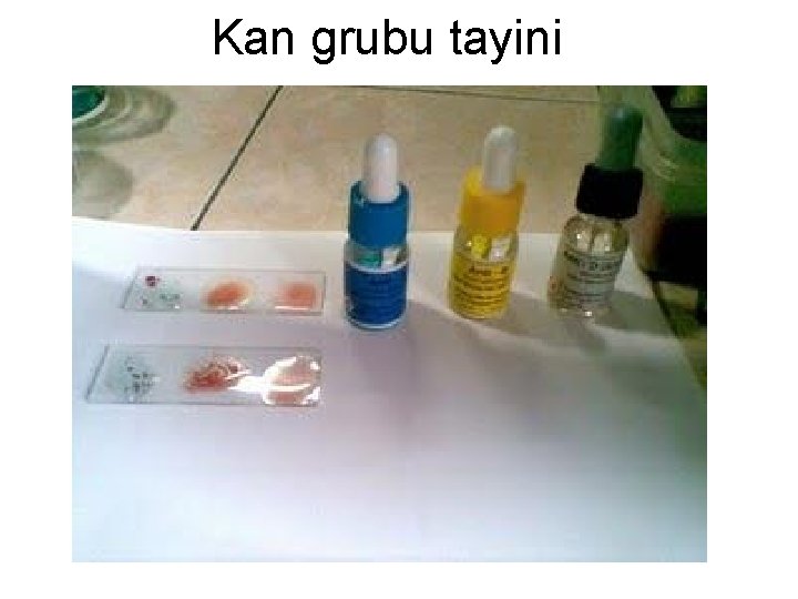 Kan grubu tayini 