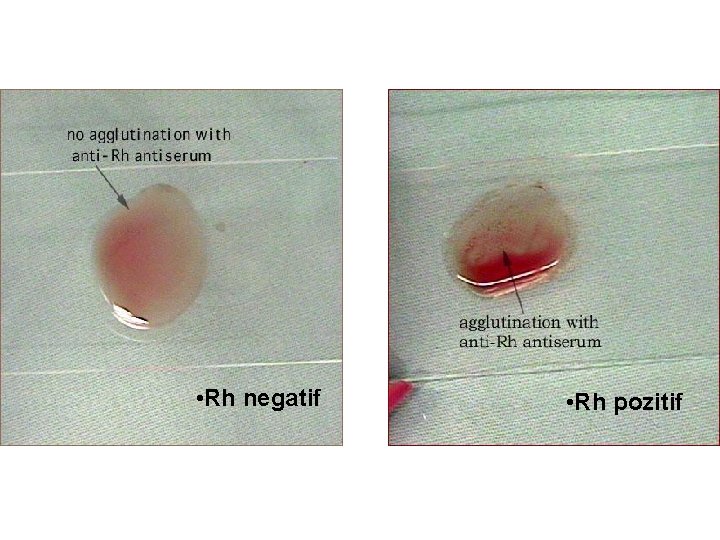  • Rh negatif • Rh pozitif 