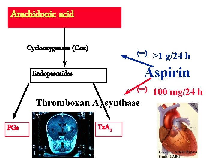 Arachidonic acid Cyclooxygenase (Cox) (-) >1 g/24 h Aspirin Endoperoxides (-) 100 mg/24 h