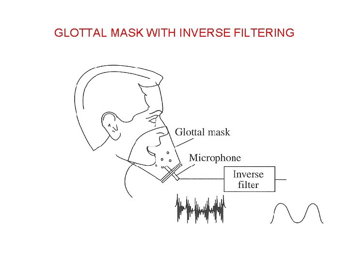 GLOTTAL MASK WITH INVERSE FILTERING 