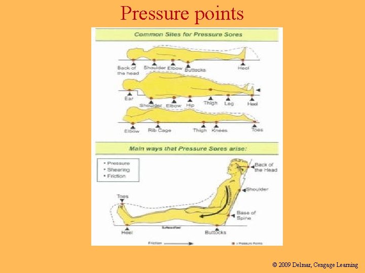 Pressure points © 2009 Delmar, Cengage Learning 