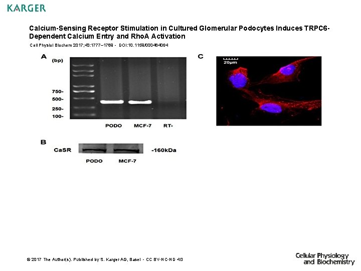Calcium-Sensing Receptor Stimulation in Cultured Glomerular Podocytes Induces TRPC 6 Dependent Calcium Entry and