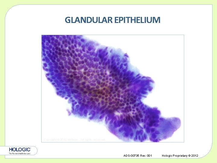 GLANDULAR EPITHELIUM Copyright © 2012 Hologic, All rights reserved. ADS-00735 Rev. 001 Hologic Proprietary