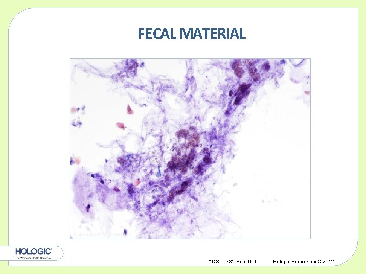 FECAL MATERIAL Copyright © 2012 Hologic, All rights reserved. ADS-00735 Rev. 001 Hologic Proprietary