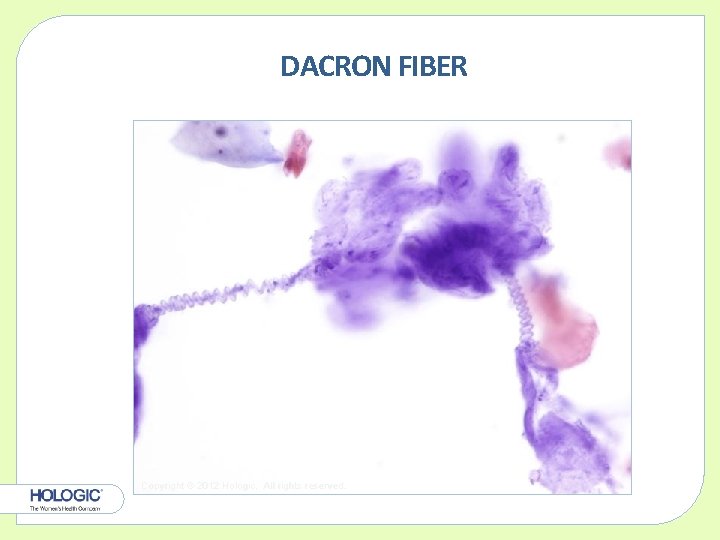 DACRON FIBER Copyright © 2012 Hologic, All rights reserved. 