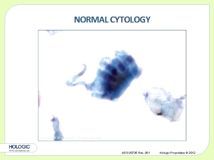 NORMAL CYTOLOGY Copyright © 2012 Hologic, All rights reserved. ADS-00735 Rev. 001 Hologic Proprietary
