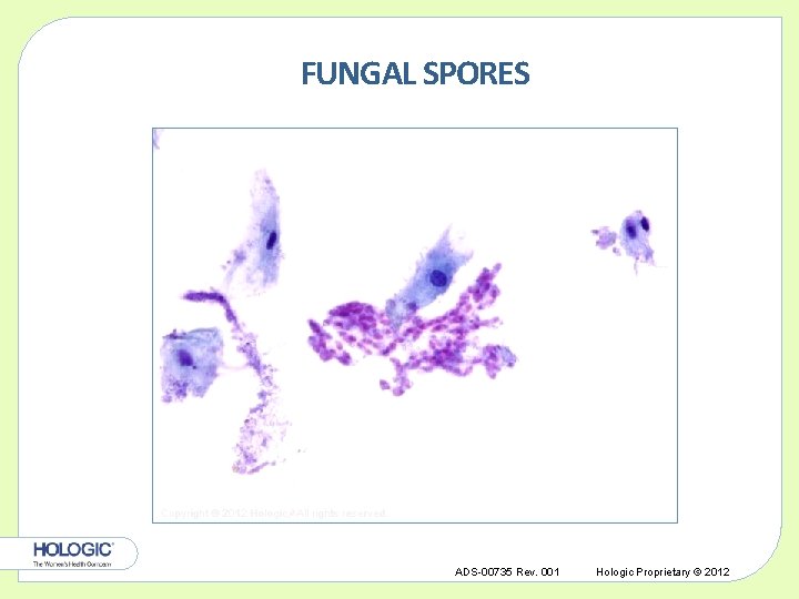 FUNGAL SPORES Copyright © 2012 Hologic, All rights reserved. ADS-00735 Rev. 001 Hologic Proprietary