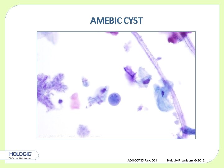 AMEBIC CYST Copyright © 2012 Hologic, All rights reserved. ADS-00735 Rev. 001 Hologic Proprietary