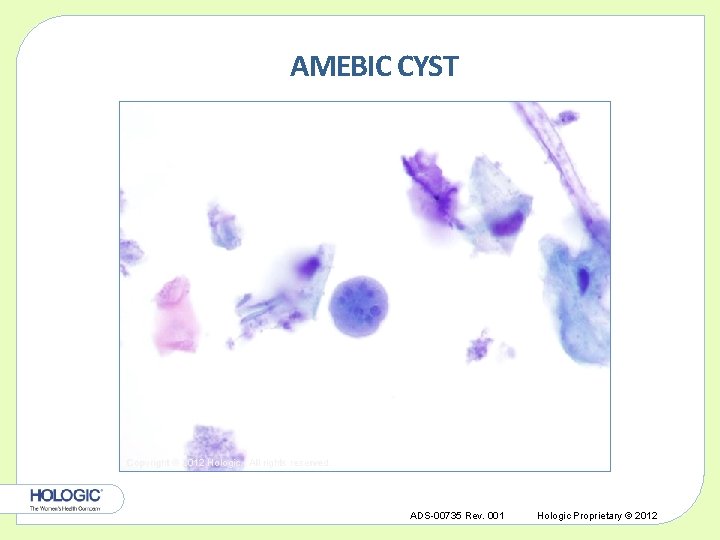 AMEBIC CYST Copyright © 2012 Hologic, All rights reserved. ADS-00735 Rev. 001 Hologic Proprietary