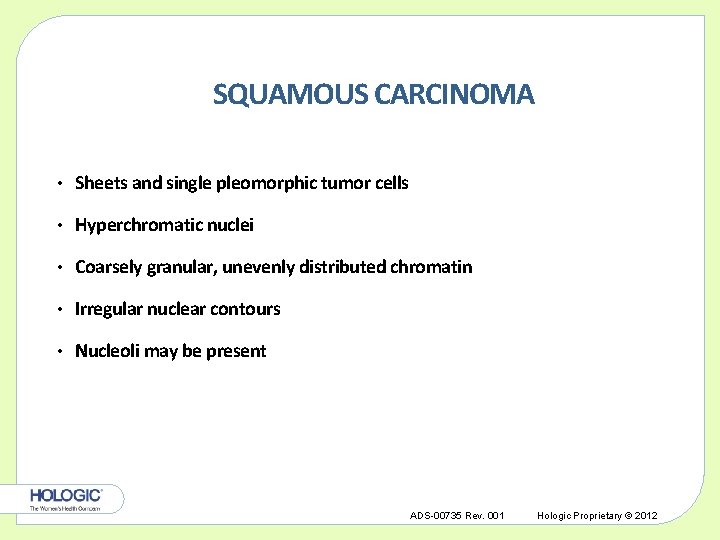 SQUAMOUS CARCINOMA • Sheets and single pleomorphic tumor cells • Hyperchromatic nuclei • Coarsely