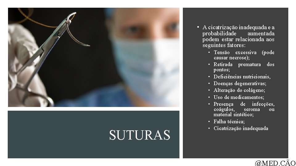  • A cicatrização inadequada e a probabilidade aumentada podem estar relacionada aos seguintes
